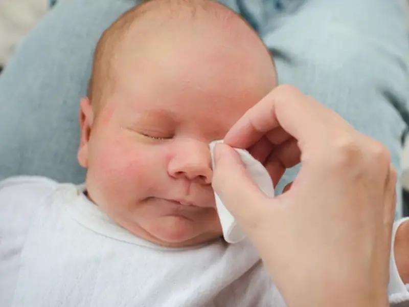 Göz Çapaklanması ve Bebeğinizin Göz Bakımı